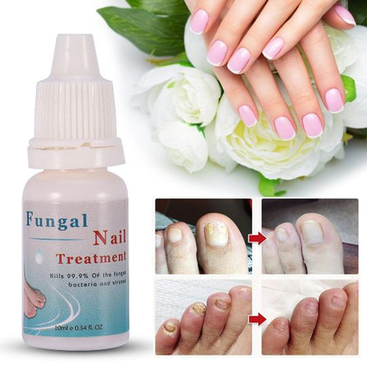 Moisturizing nail liquid 10ml gray nail repair liquid nourishing armor armor sterilization product